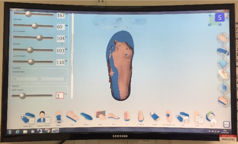 bespoke-orthotics-part-manufacture